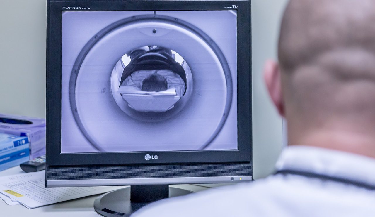 Zaspokój rosnące zapotrzebowanie na obrazowanie- mobilne aparaty tomografii komputerowej
