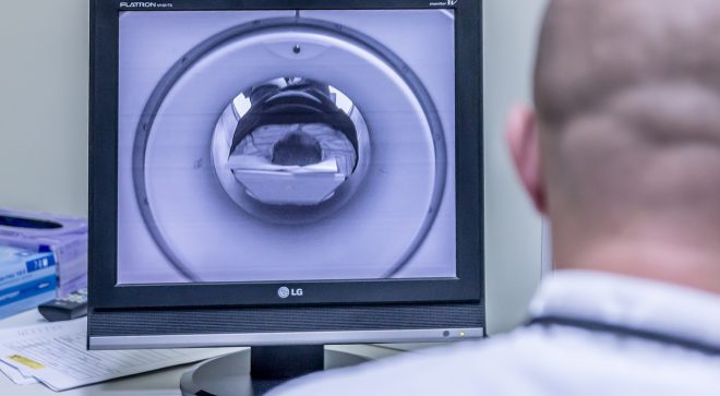Zaspokój rosnące zapotrzebowanie na obrazowanie- mobilne aparaty tomografii komputerowej