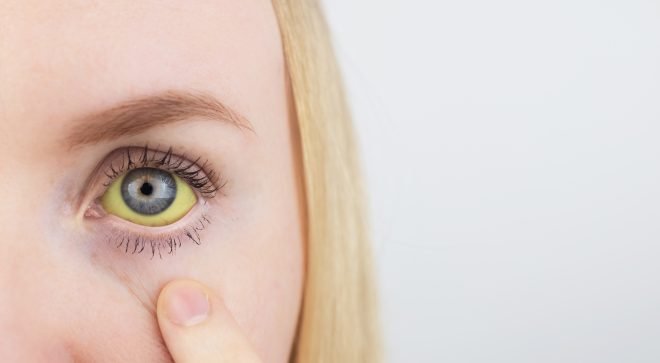 Zdążyć przed żółtym